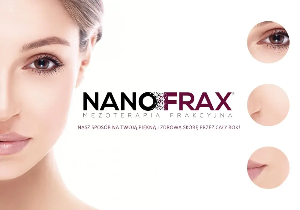 Nanofrax - Nano czy mikronakłuwanie? Sprawdź efekty i cenę zabiegu