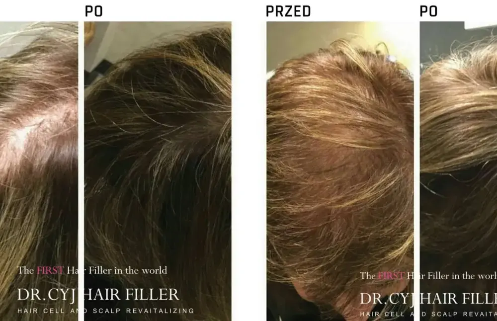 DR.CYJ Hair Filler - kiedy naprawdę ma sens?