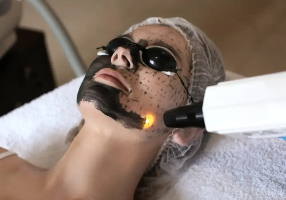 Peeling węglowy - jak szybko odświeżyć cerę? Efekty, cena i pory
