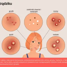 Ilustracja przedstawia różne rodzaje pryszczy: grudki, guzki, zaskórniki, krosty i torbiele.