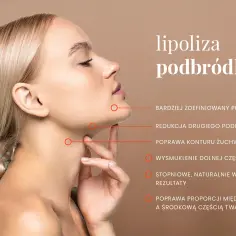 Kobieta z zaznaczonym podbródkiem. Lipoliza podbródka poprawia kontur żuchwy, wysmukla dolną część twarzy i redukuje drugi podbródek.
