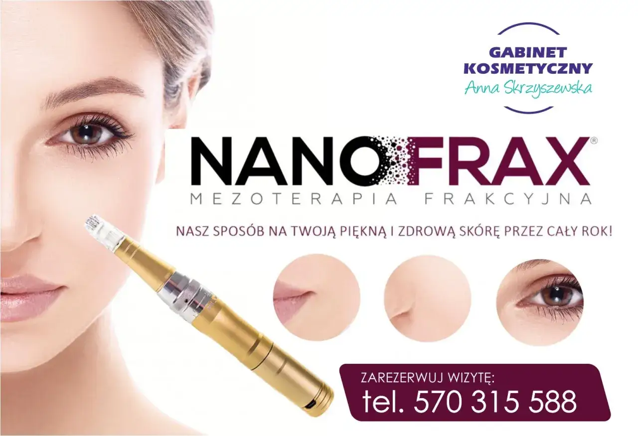 Złoty dermapen do mezoterapii frakcyjnej Nanofrax. Gabinet Kosmetyczny Anna Skrzyszewska oferuje zabiegi dla pięknej i zdrowej skóry. tel. 570 315 588.