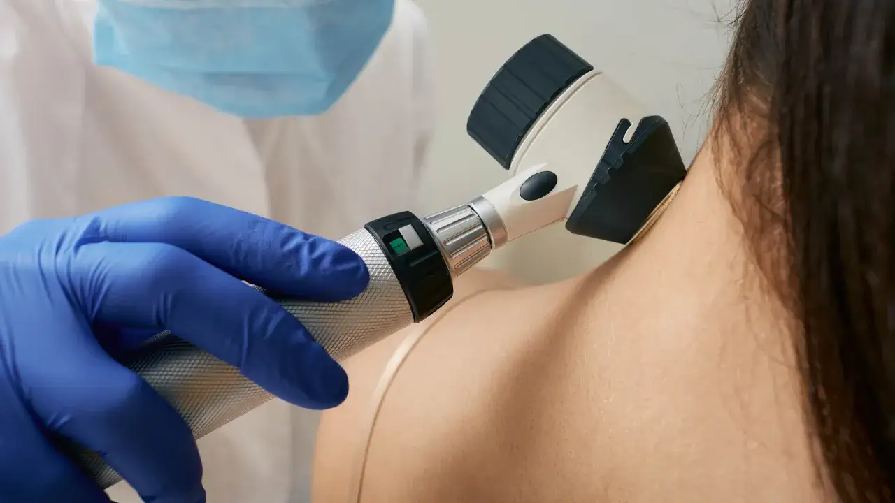 Dermatolog bada brodawki na szyi pacjenta za pomocą dermatoskopu.