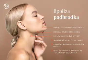 Kobieta z zaznaczonym podbródkiem. Lipoliza podbródka poprawia kontur żuchwy, wysmukla dolną część twarzy i redukuje drugi podbródek.
