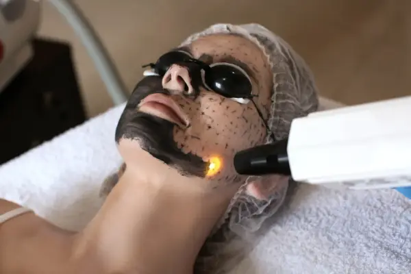 Peeling węglowy - jak szybko odświeżyć cerę? Efekty, cena i pory