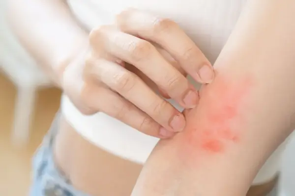 Autoimmunologiczne choroby skóry - Kiedy zmiany to coś więcej?
