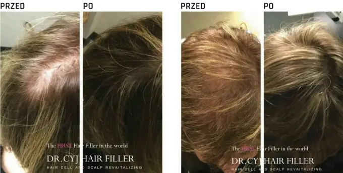 DR.CYJ Hair Filler - kiedy naprawdę ma sens?
