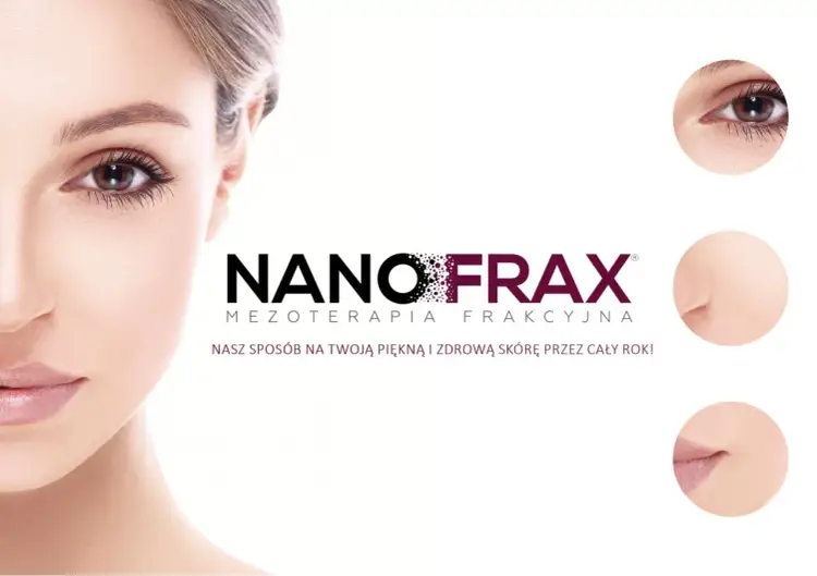 Nanofrax - Nano czy mikronakłuwanie? Sprawdź efekty i cenę zabiegu